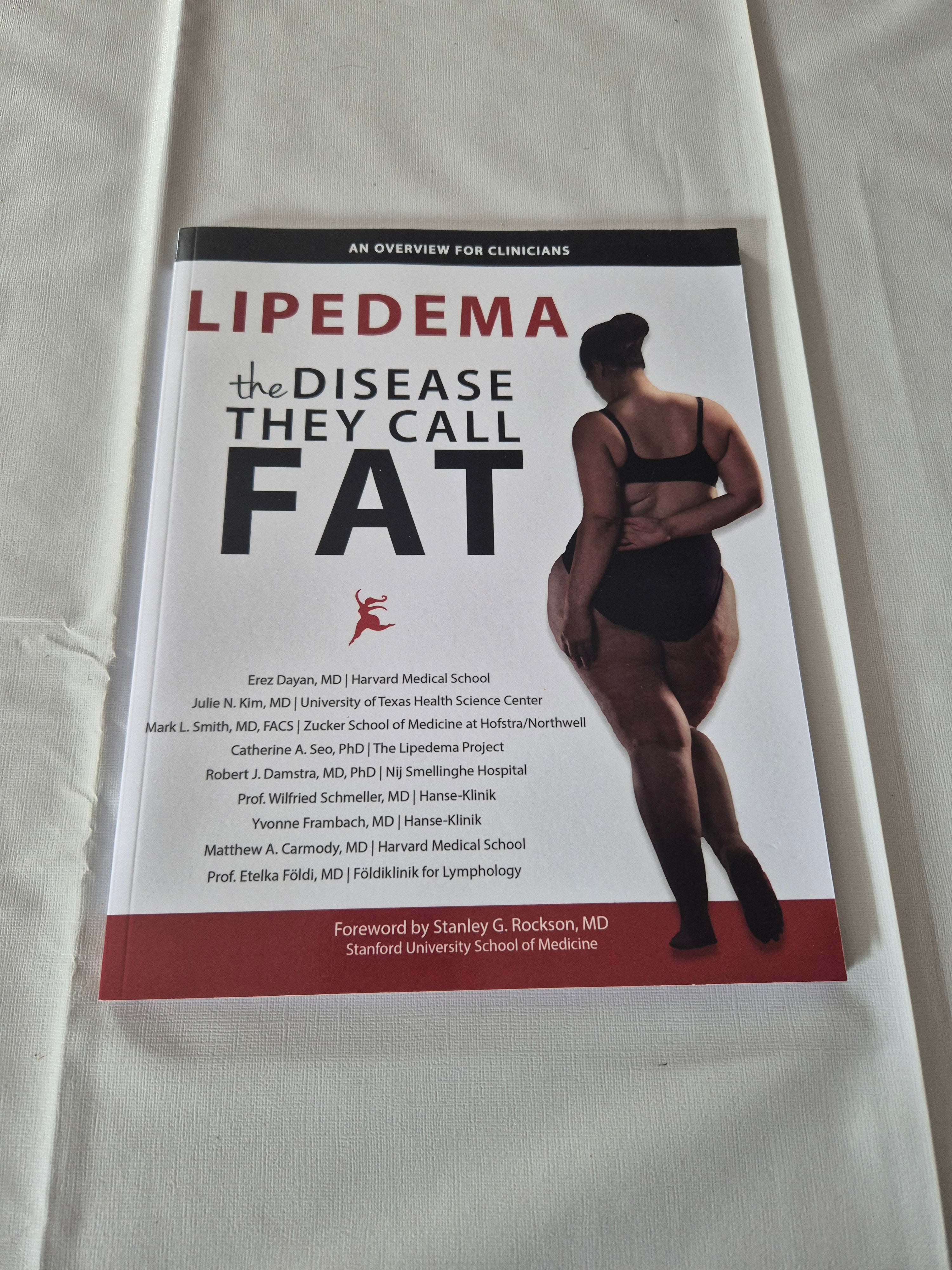 Lipedema The disease they call fat